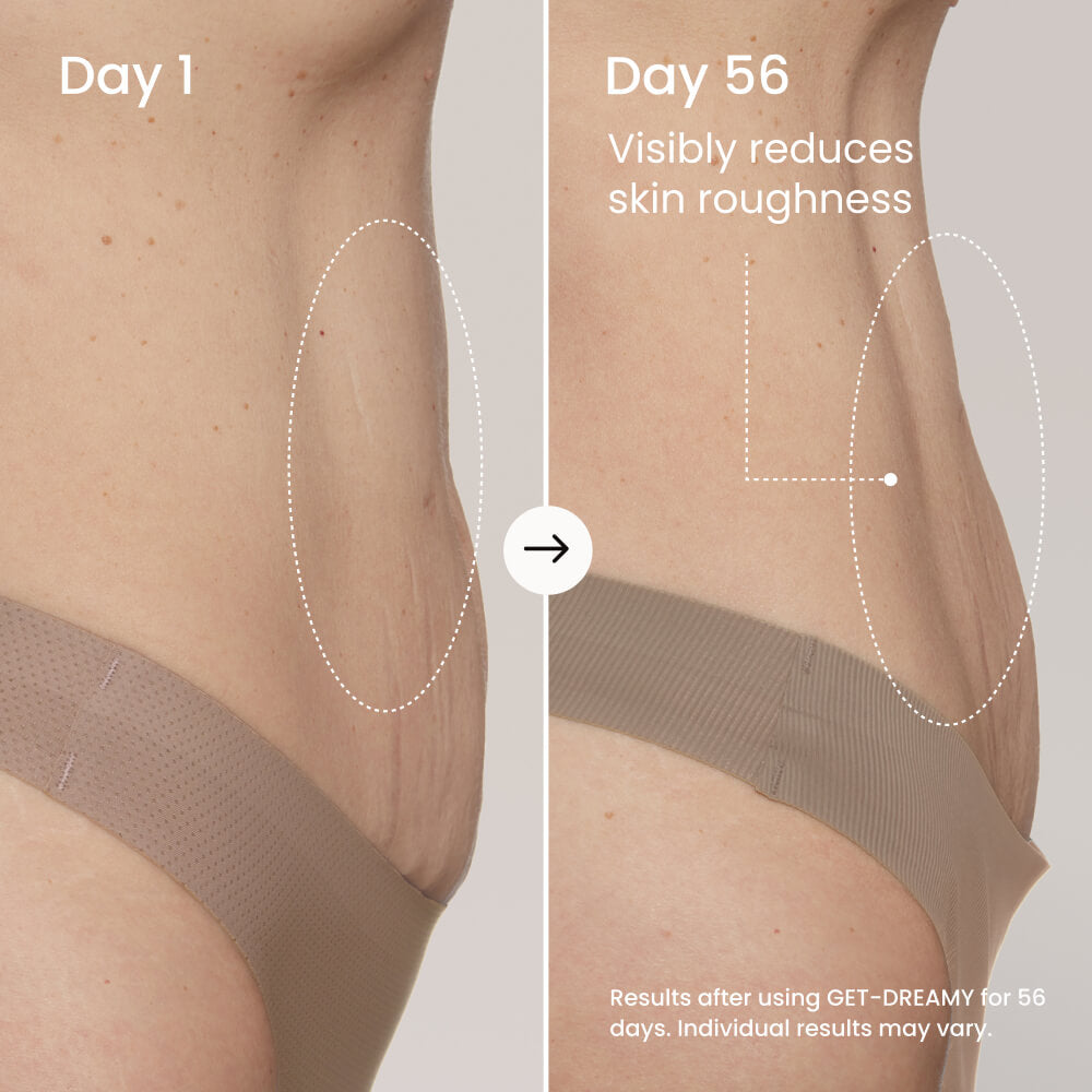 GET-DREAMY Overnight Toning Body Whip