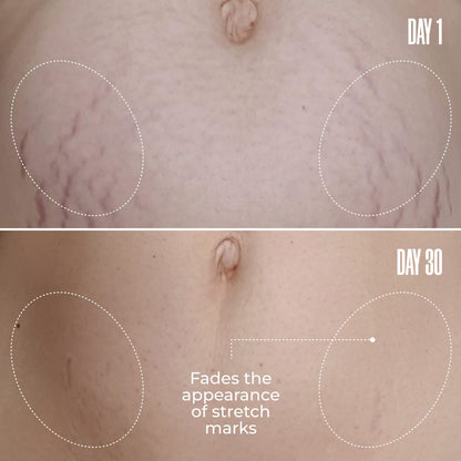 GET FLAT TERED The Skin-Smoothing Duo