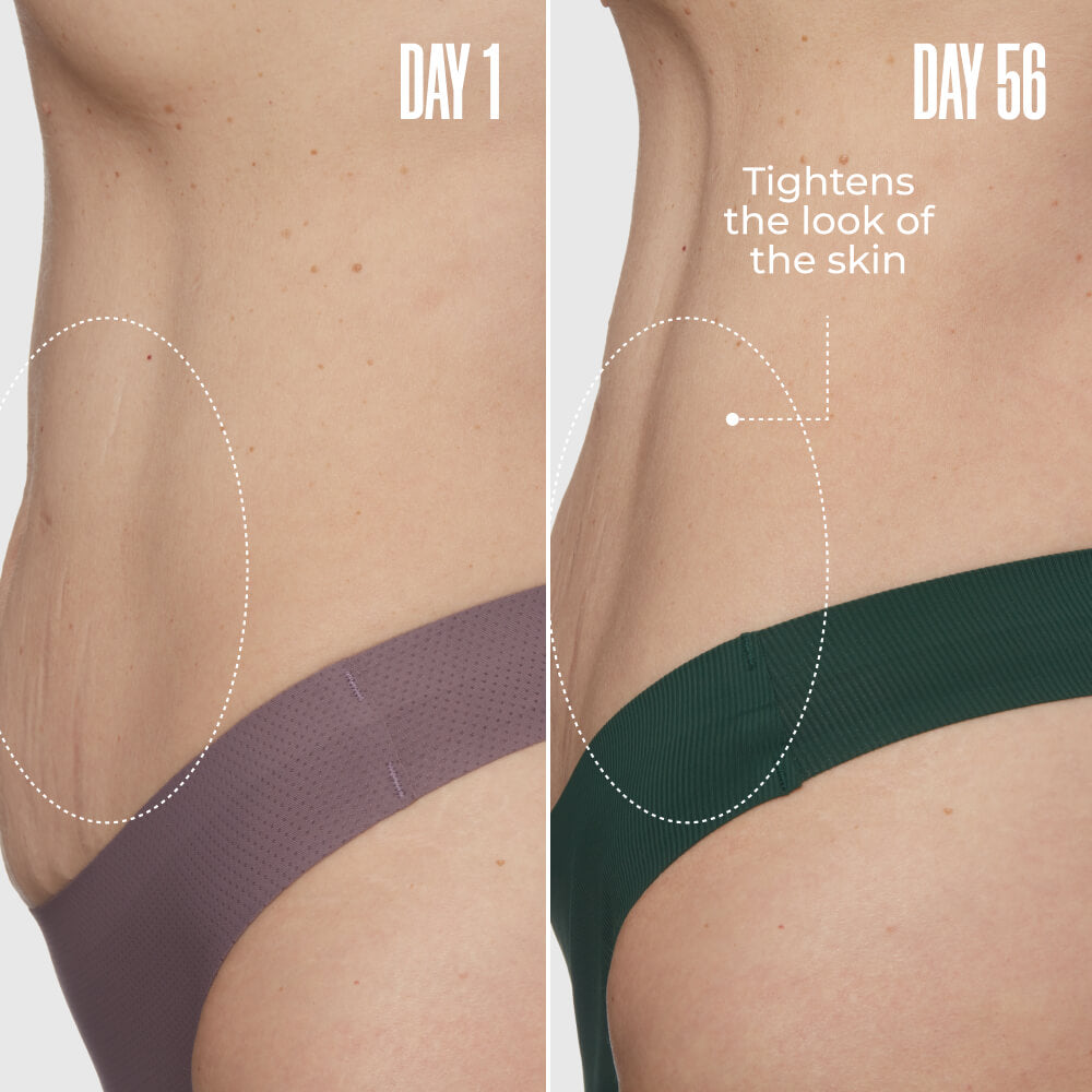 GET FLAT TERED The Skin-Smoothing Duo