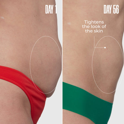 GET FLAT TERED The Skin-Smoothing Duo
